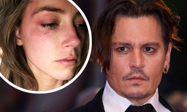 Who is lying? 50 million lawsuits between Johnny and Amber