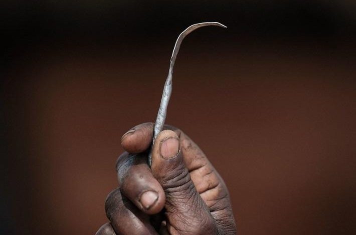 Africa: why do female genital mutilation persist?