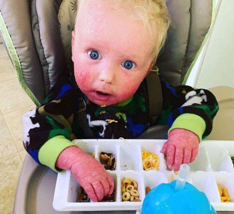 Mother and son set off because of skin condition: I felt humiliated