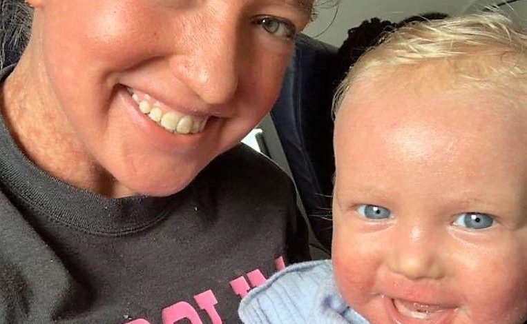 "I felt humiliated": Mother and son set off because of skin condition