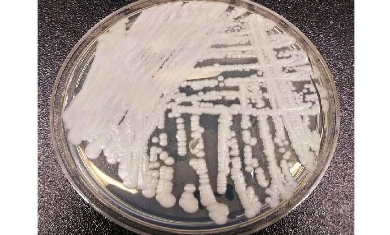 Mysterious and deadly fungal infection is spreading worldwide and nobody knows how to stop it