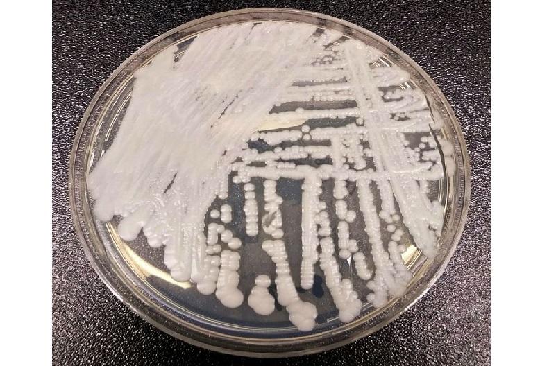 Mysterious and deadly fungal infection is spreading worldwide and nobody knows how to stop it