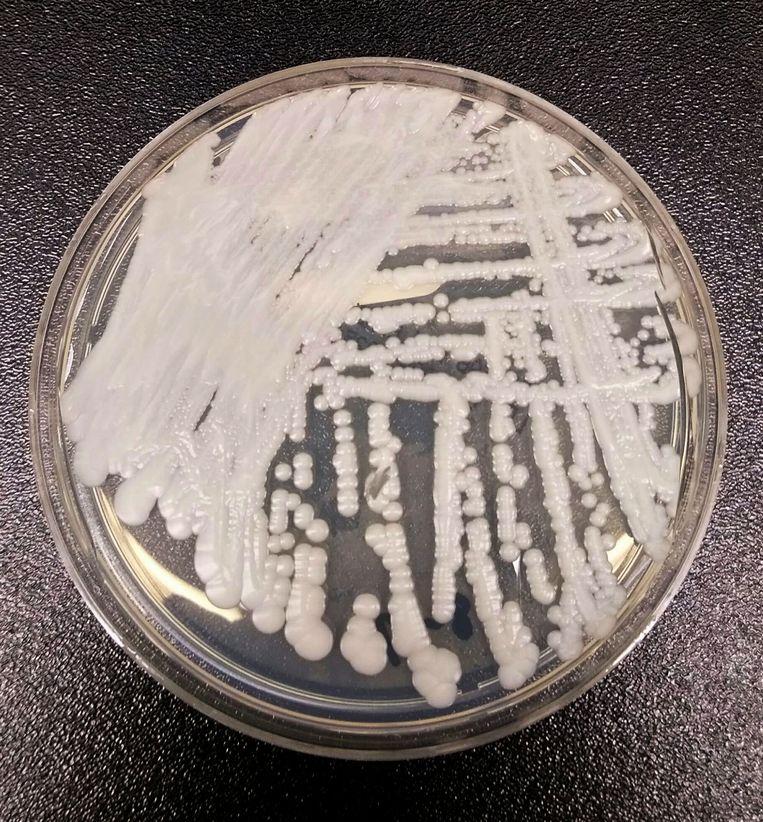  A smear in a petri dish of candida auris in the Centers for Disease Control and Prevention (CDC).