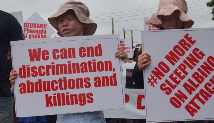 Malawi: Sentenced to death for killing an albino