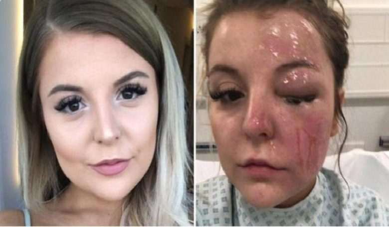 Bethany wants to cook eggs in microwave: "I followed instructions on the internet, now I risk permanent damage to my eye”