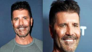 What happened to Simon Cowell's face?