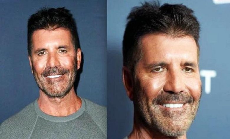 What happened to Simon Cowell's face?
