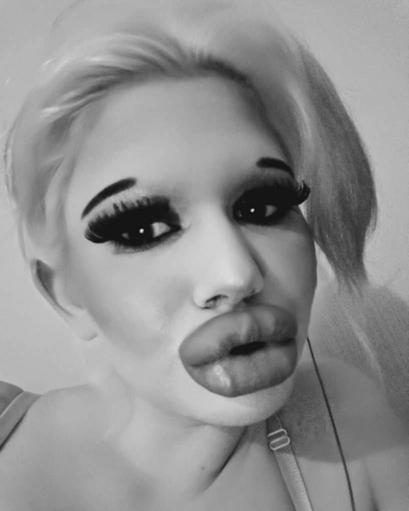 Andrea (22): “No idea if my lips can tolerate more fillers, I don’t draw any boundaries”