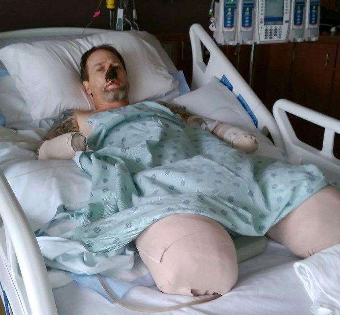 Man loses hands and legs by dog saliva, scientists find genetic cause