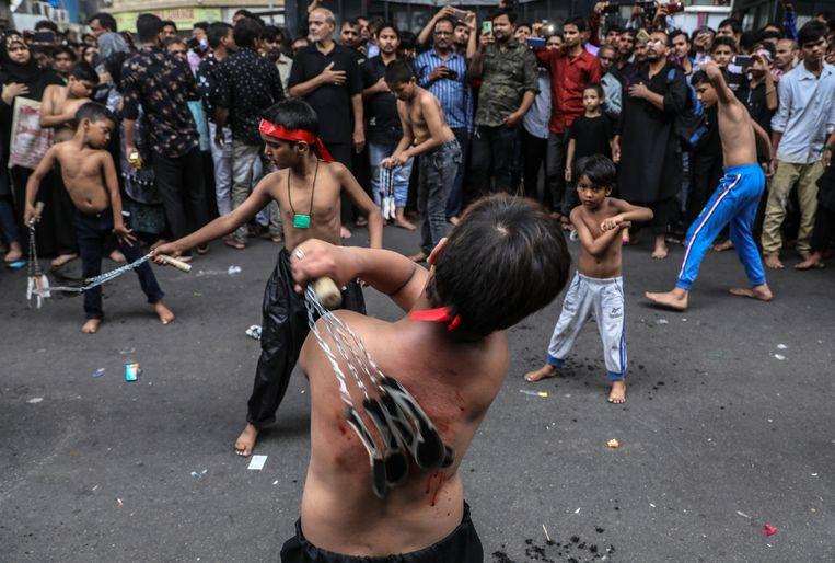 Man (60) accidentally slits his throat during sword-fighting parade