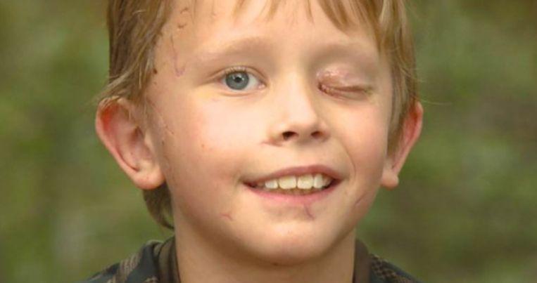 Boy (8) survives attack by cougar: “I tried to stab him in the eye”