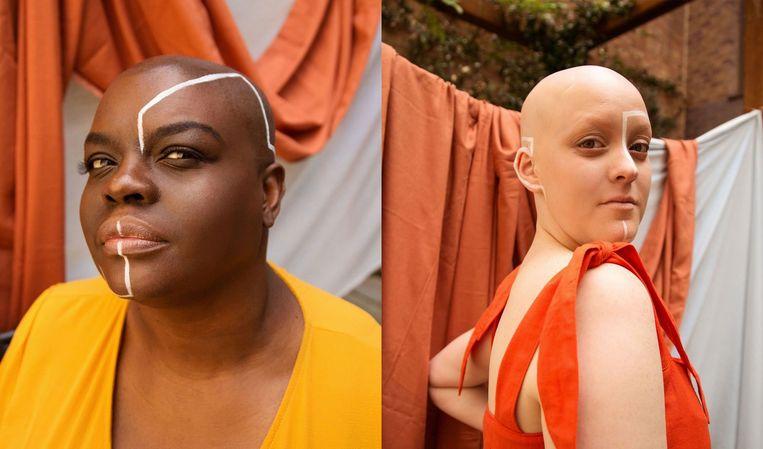 Women pose to break the taboo around the alopecia hair condition