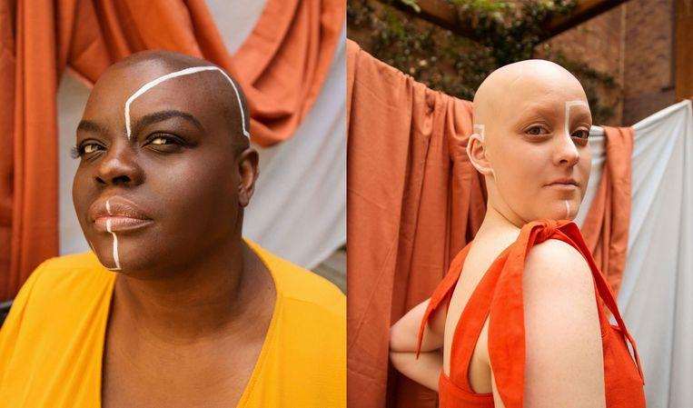 Women pose to break the taboo around the alopecia hair condition