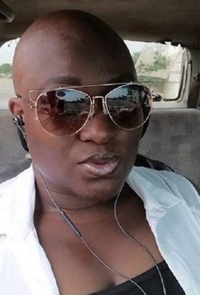 Adwowa Obeng suffers complete loss of hair syndrome for 22 years