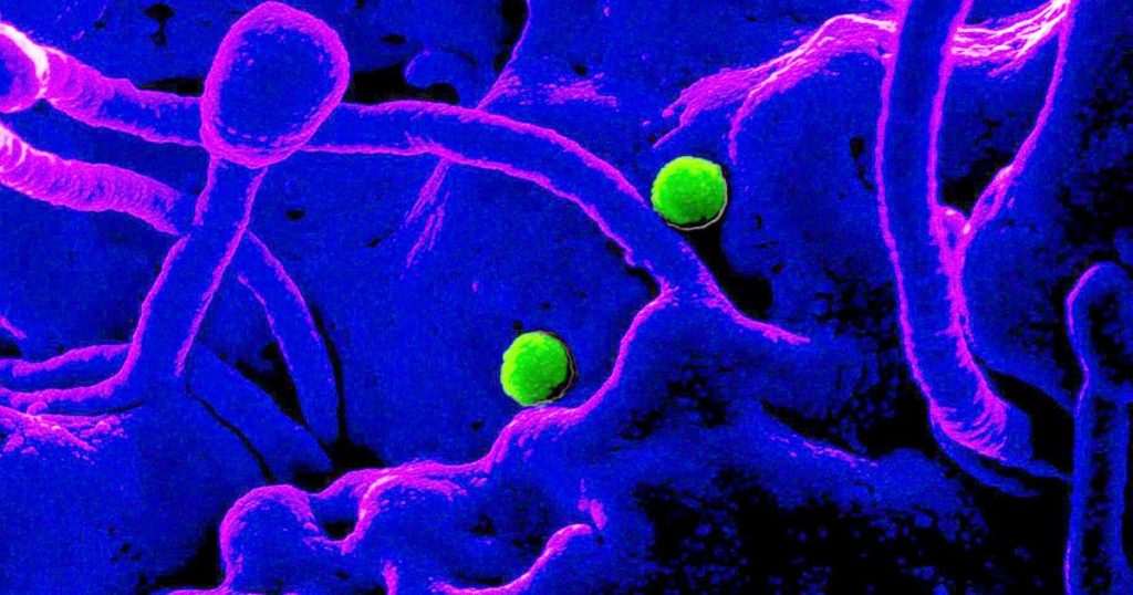 All questions about 2019-nCoV virus mysterious Chinese virus: what to do? 