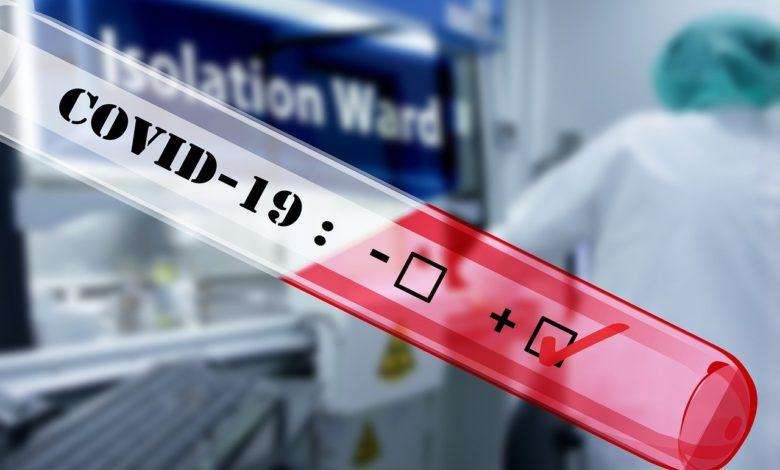 4 New confirmed Coronavirus cases in Nigeria