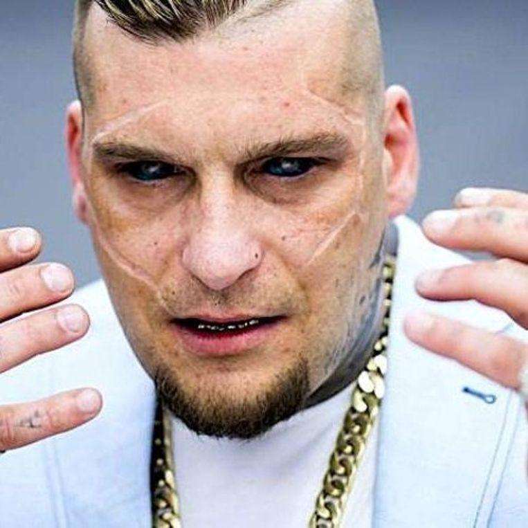 Model almost blind, she wants to imitate rapper by tattoed her eyeballs