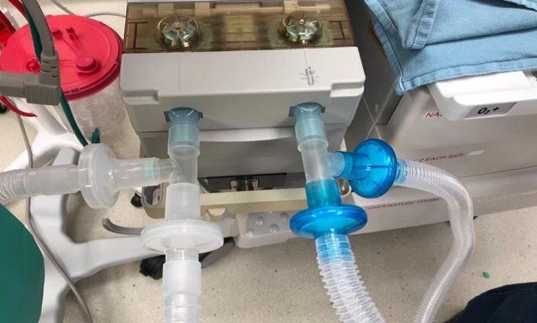 Doctor builds one ventilator for 9 corona patients at the same time: ‘Works perfectly’