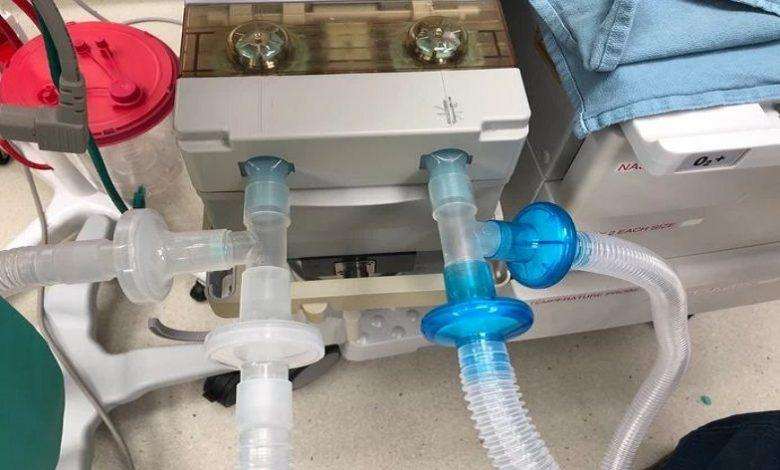 Doctor builds one ventilator for 9 corona patients at the same time: ‘Works perfectly’