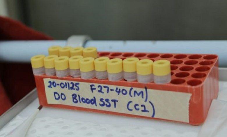 Australian scientists test Covid-19 vaccine
