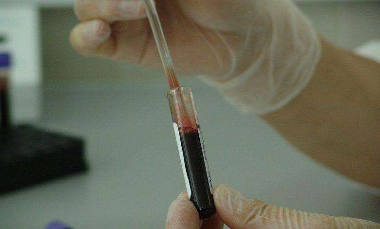 3 healings in Austria with plasma from recovered corona patients