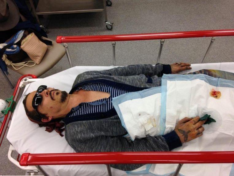Johnny Depp is taken to hospital after losing a fingertip