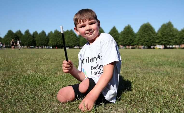 Parents abused baby so much that he lost both legs, 5 years later he raises £1M