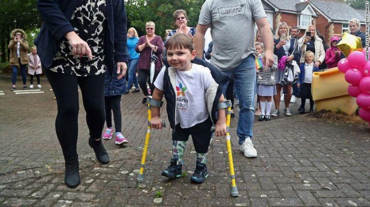 Parents abused baby so much that he lost both legs, 5 years later he raises £1M