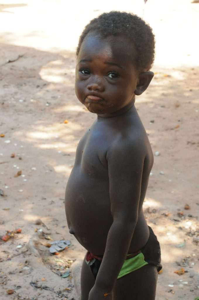 This African life is not fair, and life is not balanced