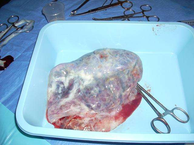 Consuming your placenta