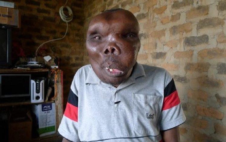 Ugandan “ugliest man” marries third woman with great pomp