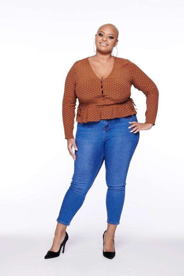 Top 5 women who have Alopecia and embraced their baldness