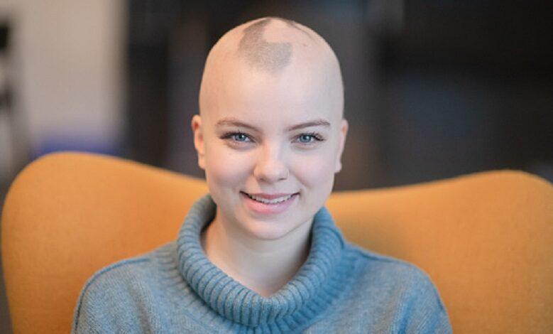 Top 5 women who have Alopecia and embraced their baldness