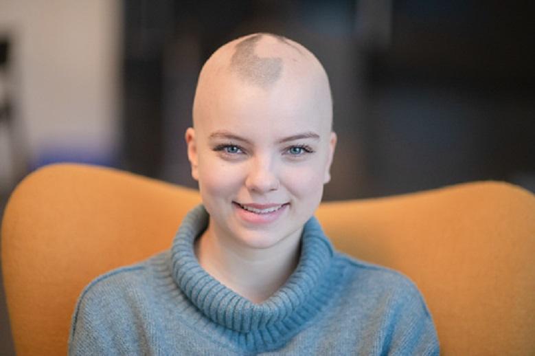 Top 5 women who have Alopecia and embraced their baldness
