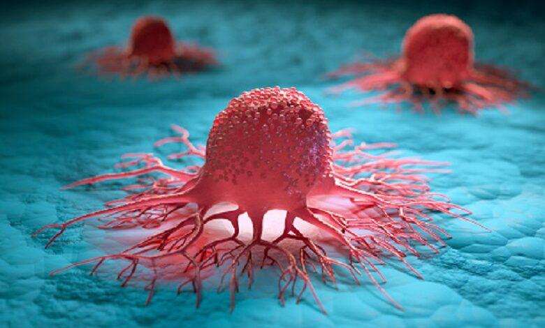 Globally, cardiovascular disease remains the main killer, but in rich countries, cancer has become the leading cause of death