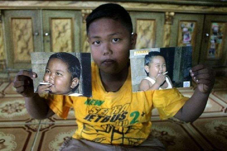 Life change of the 2-year-old who smokes 40 cigarettes a day 