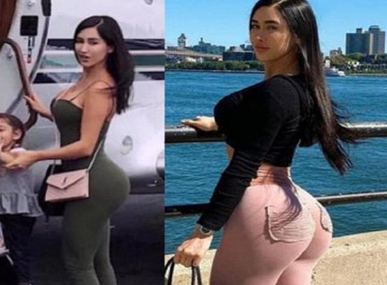 ‘Mexican Kim Kardashian’ dies after famous buttock surgery