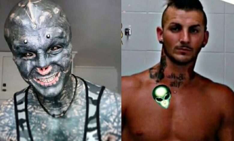 Anthony Loffredo wants to become a “black alien” by removing his nose and lip cut but unfortunately finding it difficult to speak