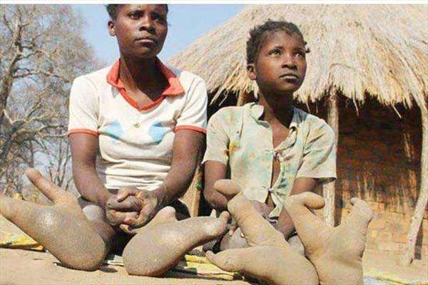 Vadoma: The Zimbabwe tribe that has only two toes on each foot
