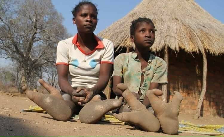 Vadoma: The Zimbabwe tribe that has only two toes on each foot