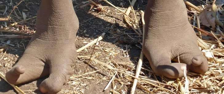 Vadoma: The Zimbabwe tribe that has only two toes on each foot