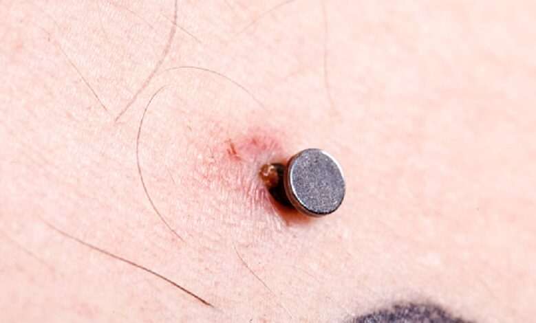 Some potential problems associated with body piercing