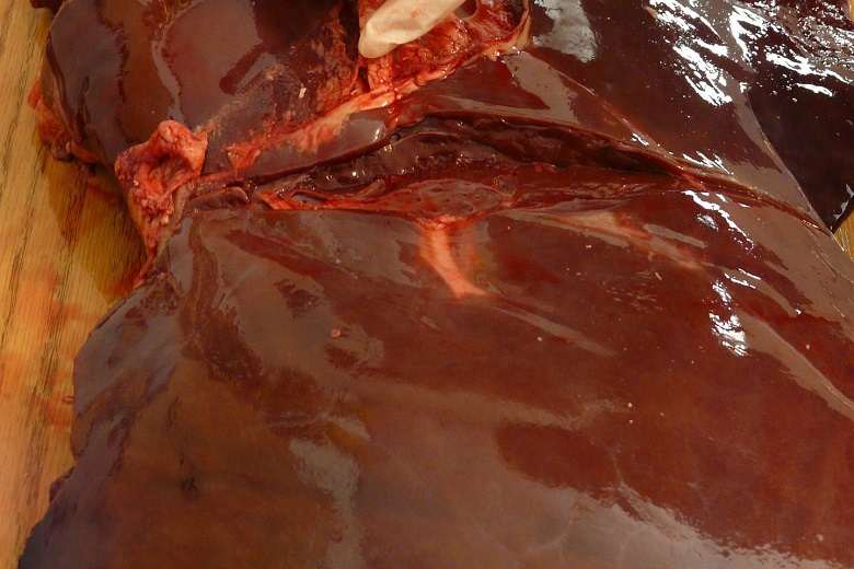 Liver