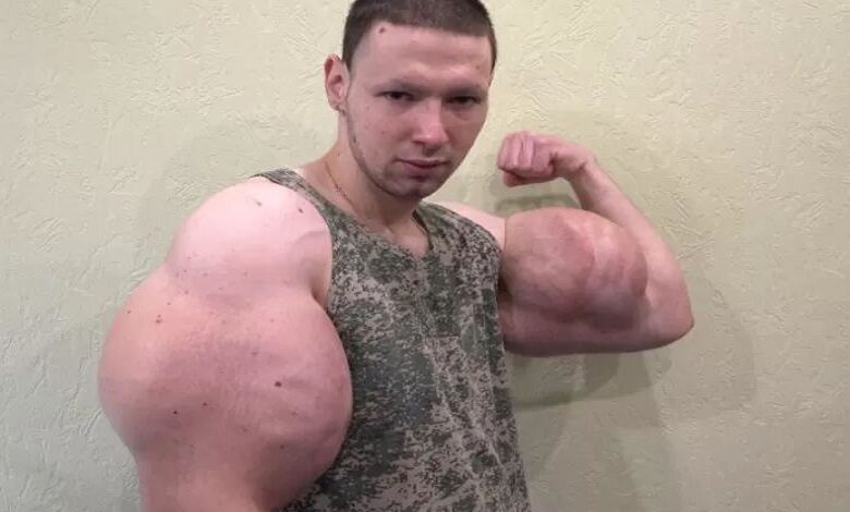 Man injected oil into his biceps, he fears losing arms