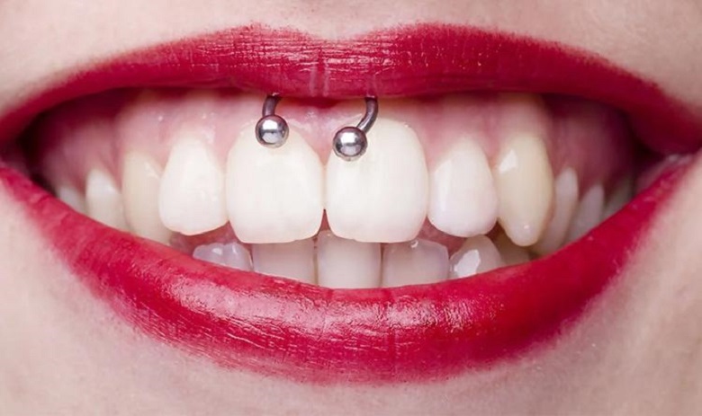 Frenum piercing or smile