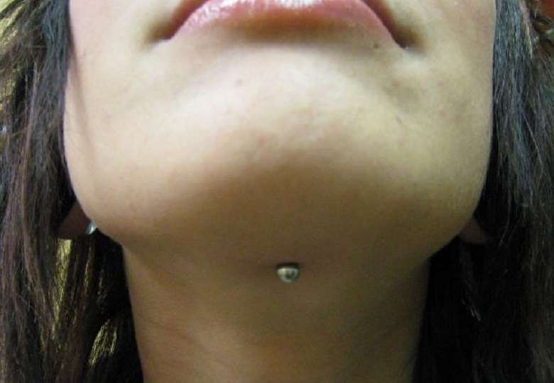 Mandible piercing
