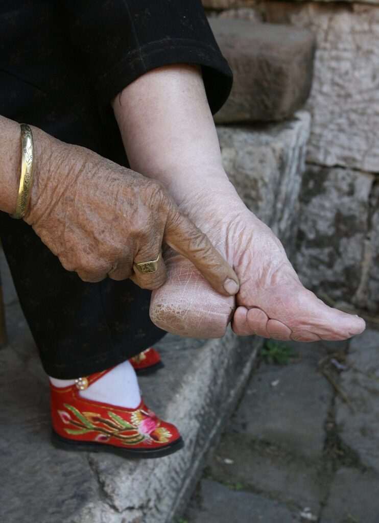 5 wild traditions that crippled women around the world