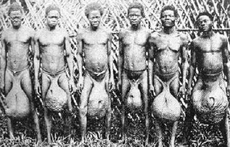 Bubal tribe: a tribe of bad dancers with giant testicles