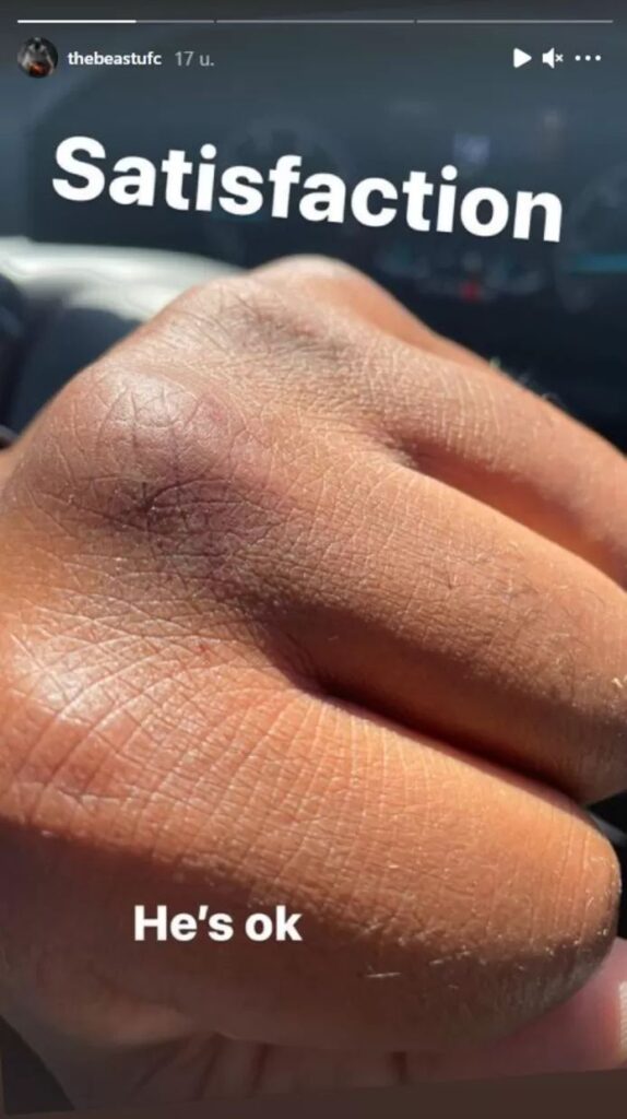 Lewis’s fist after he was done with the thief
