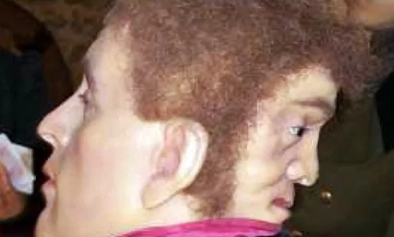 Man with two faces! When front face laughed, back face cried